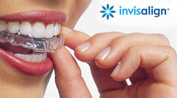 invisalign-renatosartori