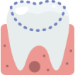 gum-1 gum-1